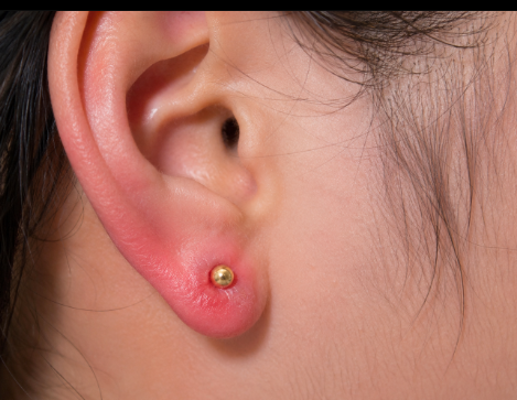 How to Choose Earrings for Sensitive Ear